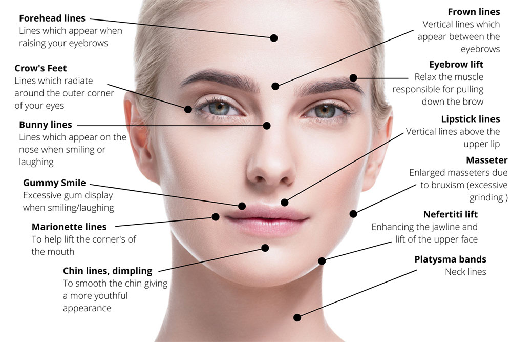 Anti Wrinkle Injections Restoration Medicine